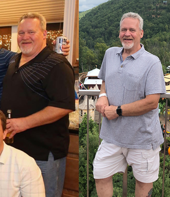 Jim before and after